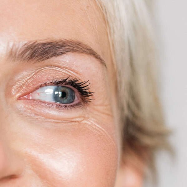 09-The adverse signs of ageing